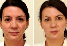 3 litra vode dnevno, zadivljujući rezultati nakon samo 4 sedmice