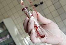 Druga beba u Americi izliječena od HIV-a?