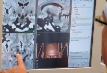 Na KCUS-u druženje s oboljelima od Parkinsonove bolesti