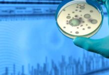 ŠKOTSKA: Potvrđen slučaj ebole