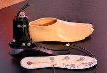 Implantirana prva proteza koja prenosi osjete