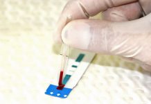 BANJA LUKA: Testirajte se besplatno na hepatitis