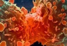 TURSKA: Nova era u borbi protiv raka