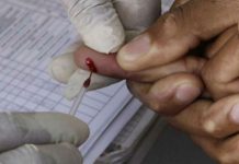 TBC i AIDS vodeći uzročnici smrti od zaraznih bolesti