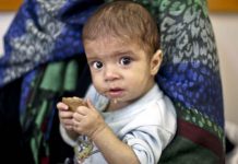 Siromaštvo u Gazi najviše pogađa najmlađe: Neuhranjeno svako šesto dijete