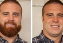 Veća vjerovatnost da će obrijani muškarci na licu nosit bakterije