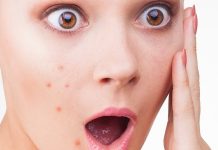 SVAKA BUBULJICA KRIJE TAJNU: Evo šta mjesto gdje se pojavi govori o vašem zdravlju!