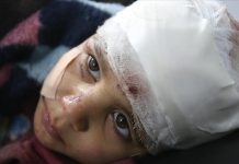 Idlib: Desetogodišnjoj djevojčici u naručju poginula mlađa sestra tokom zračnog napada