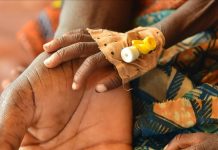 Svako veče više od 820 miliona ljudi ide gladno na spavanje