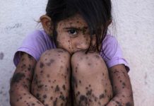 (FOTO) GMO razara Argentinu