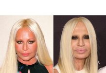 donatella-versace-face-transformation-gty-2-ftr