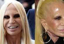 donatella_versace_plastic_surgery