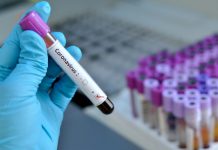 Šta koronavirus radi organizmu: Izaziva tešku upalu pluća, zatajenje bubrega, sepsu