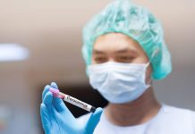 U Srbiji još osam zaraženih korona virusom, ukupno 65 pozitivnih