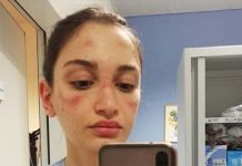 Ovako izgleda lice medicinske sestre iz Italije: “Molim svakoga ko ovo čita…”