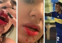 Igrač Boce Juniors pretukao djevojku, a ona sve objavila na Instagramu: “Ovo je pravi Sebastian”