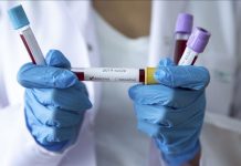 Novih 35 zaraženih koronavirusom u RS-u, među njima pet zdravstvenih radnika