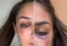 Reprezentativke BiH u karateu, sestre Ema i Ena Selman, pretučene u svome stanu