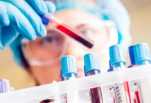 Zlatnu krvnu grupu ima nešto manje od 50 ljudi na cijelom svijetu