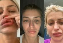 DRAMATIČNA SNIMKA: Manekenka objavila video na kojem nasrće na nju; ‘Želi mi oduzeti dijete’