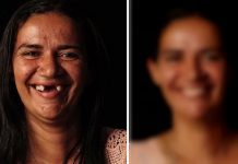 Zubar besplatno popravlja zube siromašnima, njihove transformacije su čudesne