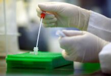 U Francuskoj kod 152 djece registrovan Kawasaki sindrom