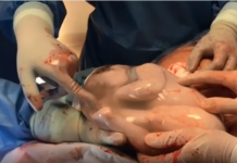 Video: Beba čvrsto spava u vodenjaku, a liječnici čekali 7 minuta da se probudi