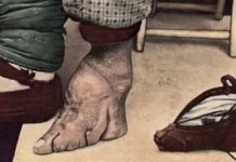 9 bizarnih tradicija kojih su se ljudi nekada davno držali kako bi drugima izgledali ljepše