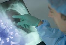 Njemačka lansira aplikaciju za koronavirus, poznato i kako će funkcionirati