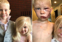 Mali heroj! Šestogodišnjak spasio sestricu od pobješnjelog psa