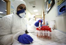 ZZO KS: Pacijenti mogu dobiti rezultate testiranja na koronavirus putem Vibera