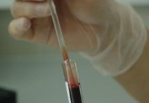 Komercijalni testovi na koronavirus u RS-u sniženi na 150 KM