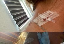 Migrant nožem napao, ozlijedio i opljačkao djevojku na Vilsonovom šetalištu u Sarajevu