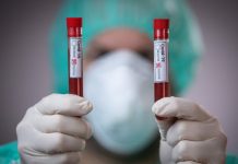 Oni koji su prebolovali koronu mogu ući u Crnu Goru: Ne vrijedi negativan serološki test?