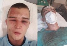 Konjic: Uhapšeno šest muškaraca koji su brutalno pretukli i iživljavali se nad 20-godišnjakom