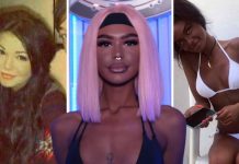 Svakodnevno ubrizgava ilegalne injekcije u tijelo kako bi bila što tamnija