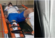 Predsjednik Craiove donio loše vijesti: Elvir Koljić mora na operaciju, da li je završio sezonu?