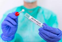 Odobrena isplata 3,7 miliona KM: RS nabavlja 90.000 PCR testova