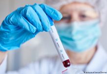 Zavod saopćio lijepe vijesti: U Sarajevu se oporavilo 177 osoba