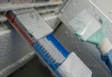 Nurkić će četiri sedmice nositi longetu