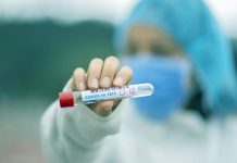 Novosel: U Hrvatskoj detektirana indijska varijanta koronavirusa