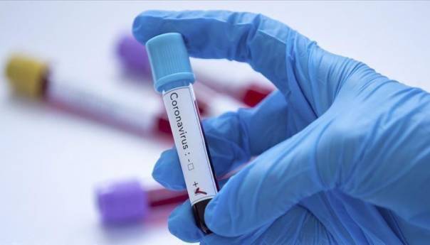 koronavirus-covid-19