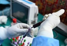 Korona u BiH: 249 novozaraženih, jedna osoba preminula