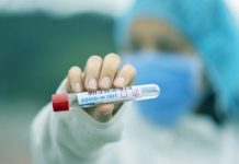 BiH: 721 novozaražena osoba, 35 umrlih