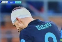 Džeki razbijena glava, Inter nanio prvi poraz Napoliju