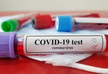 Brzi Covid testovi daju lažno negativan rezultat na omikron soj