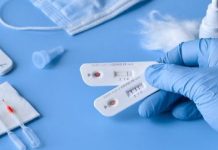 U Bosni i Hercegovini 641 novozaražena osoba, preminulo 35