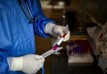 Alarmantno: BiH druga u Evropi po broju mrtvih od korone na milion ljudi