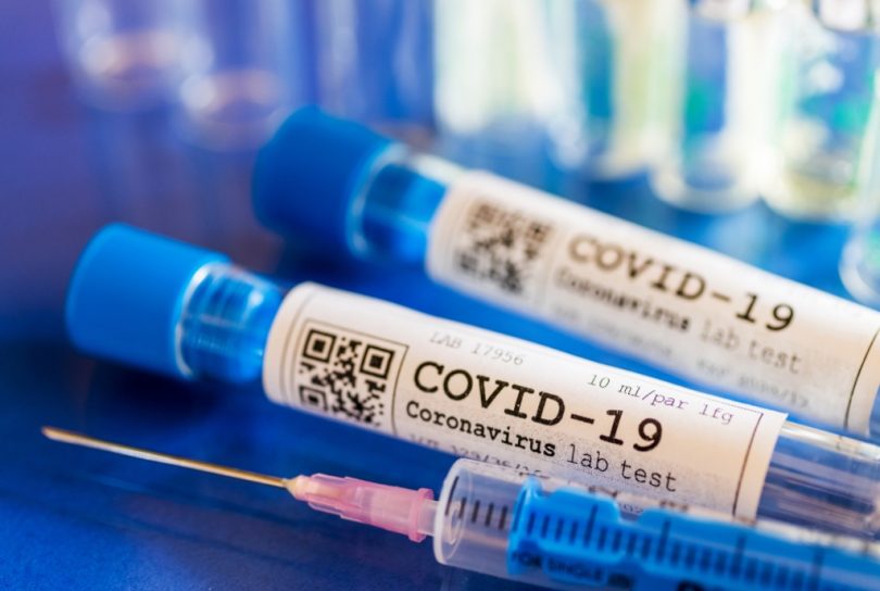 koronavirus_covid_19