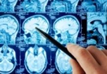 Koristimo li svoj mozak u potpunosti